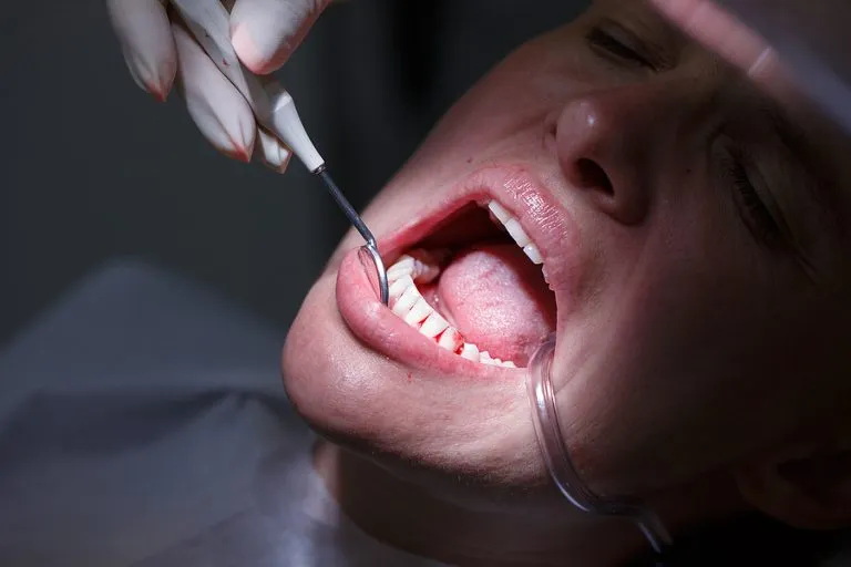 Periodontal Disease: Causes, Symptoms, and Effective Treatment Options