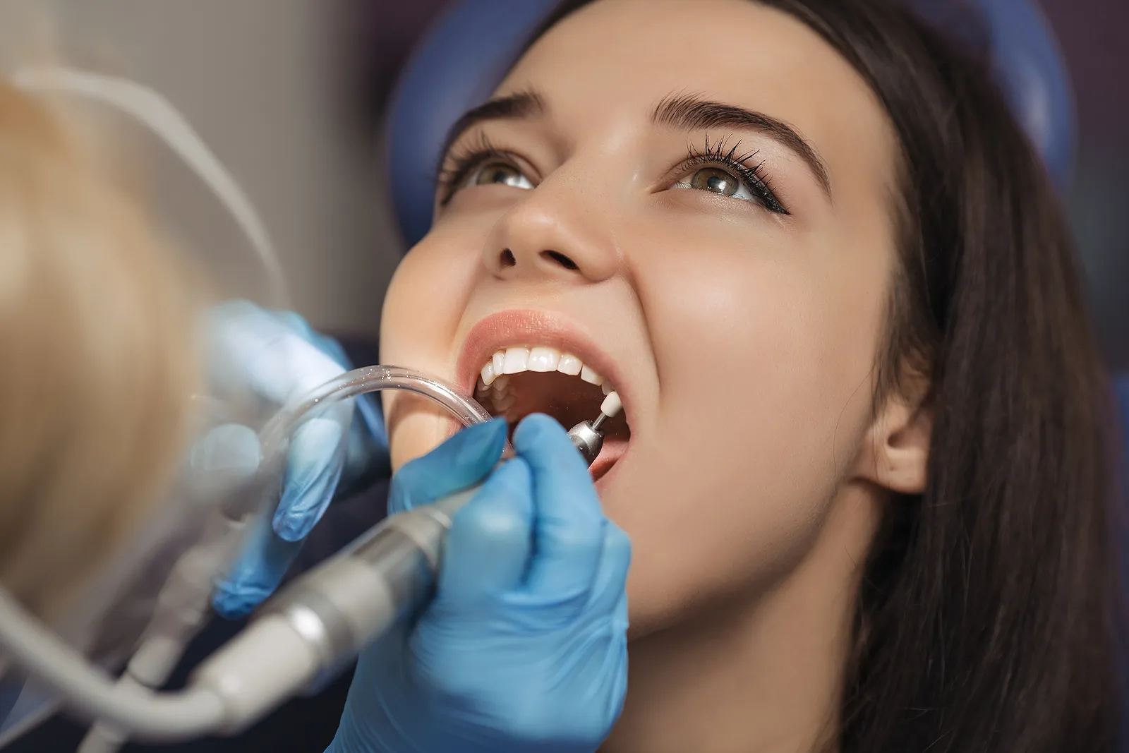 What to Expect After Root Canal Therapy: Managing Pain and Discomfort