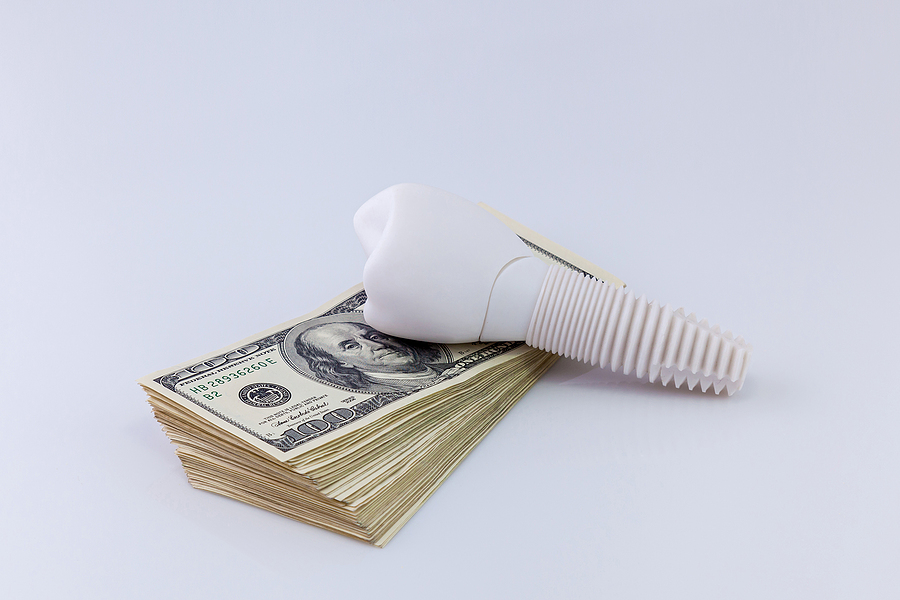 When getting the cheapest dental implant costs you way more!